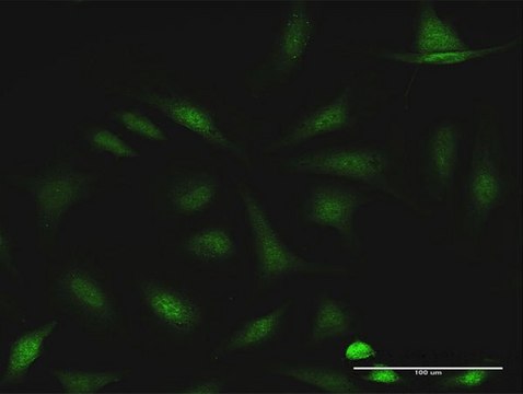 Anti-CCDC6 antibody produced in rabbit