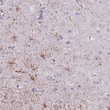 Anti-SLC35E3 antibody produced in rabbit