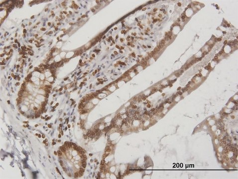 Anti-LBR antibody produced in mouse
