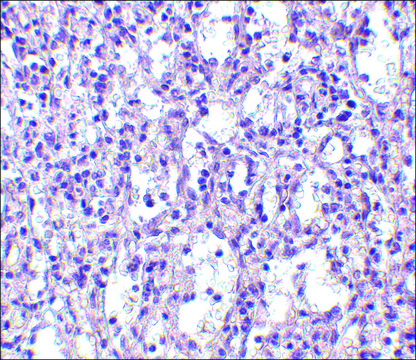 Anti-Carabin (ab2) antibody produced in