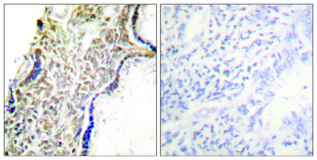 Anti-p14 ARF antibody produced in