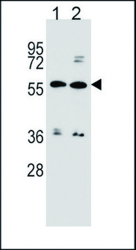 ANTI-ABCG4 (N-TERM) antibody produced in