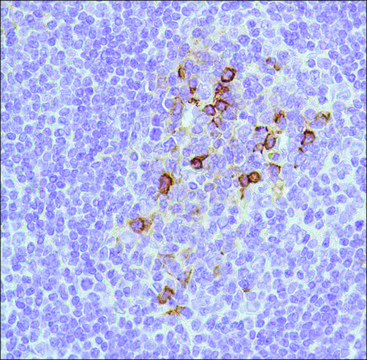 Anti-CD138 antibody, Rabbit monoclonal