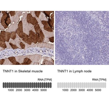 Anti-TNNT1 antibody produced in rabbit