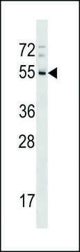 ANTI-RHD (CENTER) antibody produced in