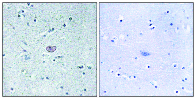 Anti-VEGFR2 antibody produced in rabbit