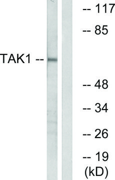 Anti-TAK1 antibody produced in rabbit