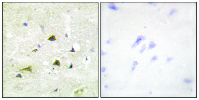 Anti-IKK-? antibody produced in rabbit