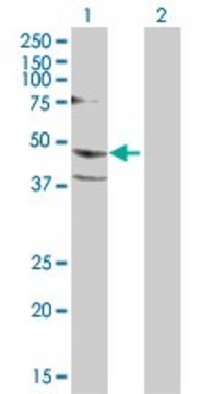 Anti-PSCD1 antibody produced in rabbit