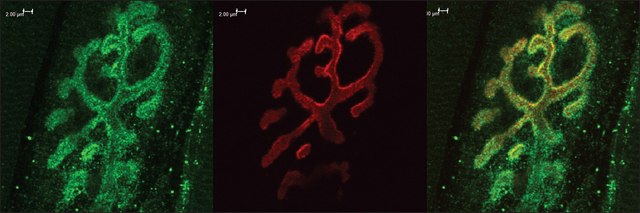 Anti-BSN antibody produced in rabbit