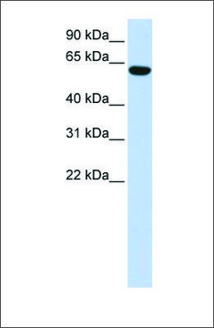 Anti-CCDC11 antibody produced in rabbit