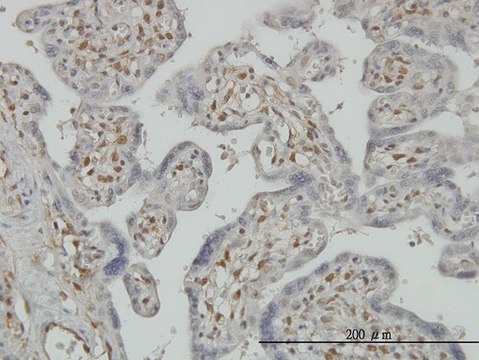 Monoclonal Anti-PAPSS2 antibody produced in