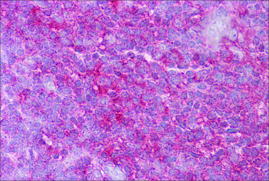 Anti-KIF2A (ab2) antibody produced in