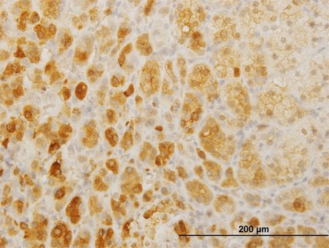 Monoclonal Anti-TWIST2 antibody produced in