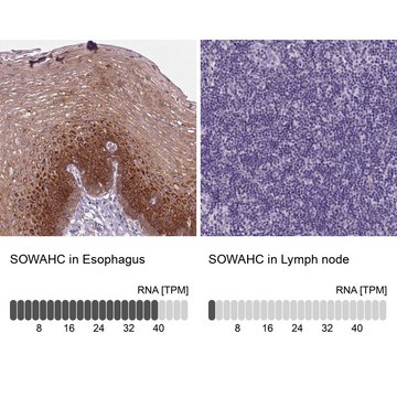 Anti-SOWAHC antibody produced in rabbit