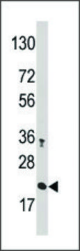 Anti-CROC1A (N-term) antibody produced in