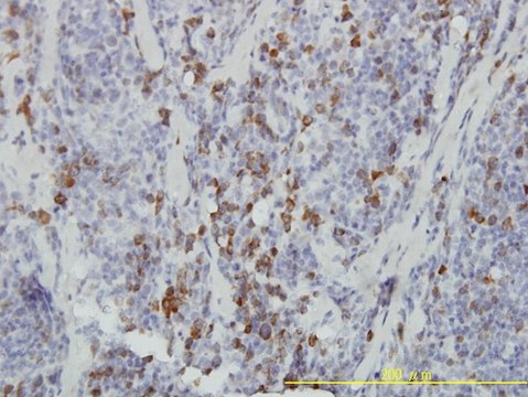 Monoclonal Anti-ASB9 antibody produced in