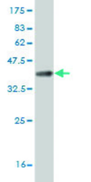 ANTI-ZIC3 antibody produced in mouse
