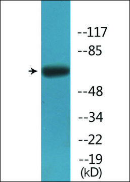 Anti-phospho-Fyn (pTyr?³?) antibody produced in