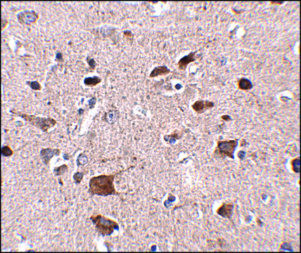 Anti-CCDC134 antibody produced in rabbit
