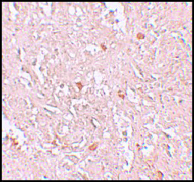 Anti-FBXL16 antibody produced in rabbit