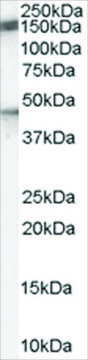 Anti-PTCH (Internal) antibody produced in
