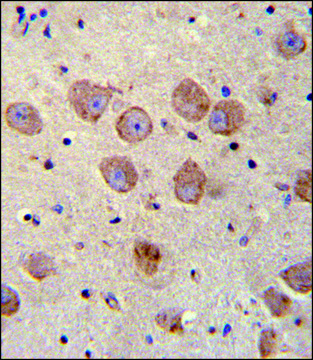 ANTI-FUSSEL18 (C-TERM) antibody produced in