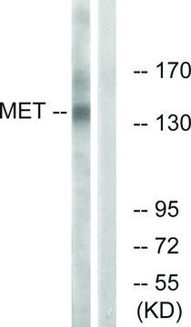 Anti-MET antibody produced in rabbit