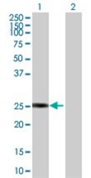 Anti-GSTZ1 antibody produced in rabbit