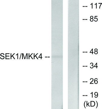 Anti-SEK1 antibody produced in rabbit