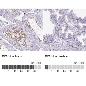 Anti-SPAG1 antibody produced in rabbit