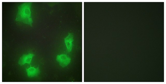 Anti-CDK5R1 antibody produced in rabbit