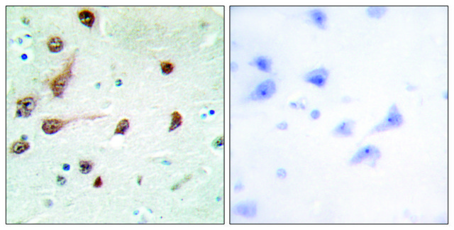 Anti-ADAR1 antibody produced in rabbit