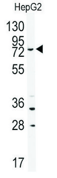Anti-ABCB8 (N-term) antibody produced in
