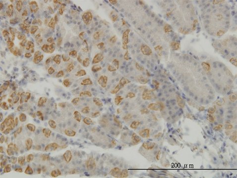 Monoclonal Anti-AATK antibody produced in