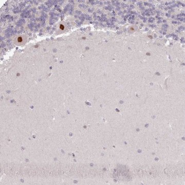 Anti-KBTBD6 antibody produced in rabbit