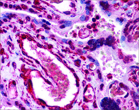 Anti-LIPG antibody produced in rabbit