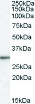 Anti-Ribosomal Protein L8 antibody produced