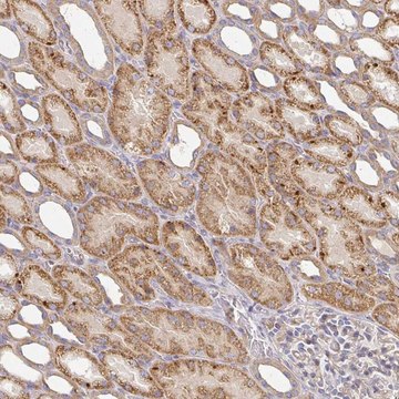 Anti-IRAK2 antibody produced in rabbit