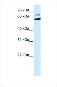 Anti-FZD8 antibody produced in rabbit