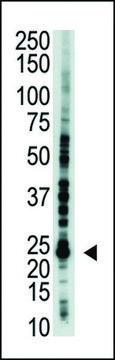 ANTI-E2EPF(C-TERMINAL) antibody produced in rabbit