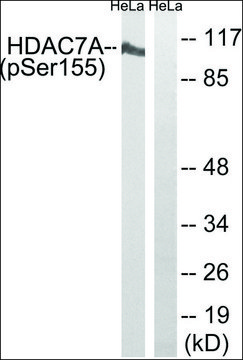Anti-phospho-HDAC7A (pSer¹??) antibody produced in