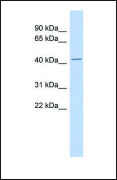 Anti-TMPO antibody produced in rabbit
