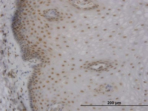 Monoclonal Anti-MBNL1 antibody produced in