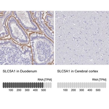 Anti-SLC5A1 antibody produced in rabbit