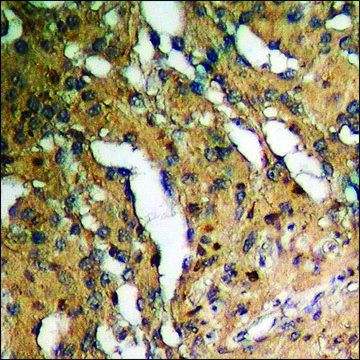 Anti-phospho-FOXO1/3/4-pan (pThr24/32) antibody produced in