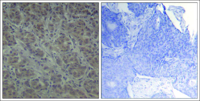 Anti-RPS6KA1 (Ab-352) antibody produced in