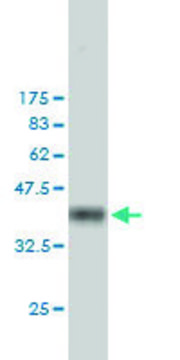 ANTI-FHIT antibody produced in mouse