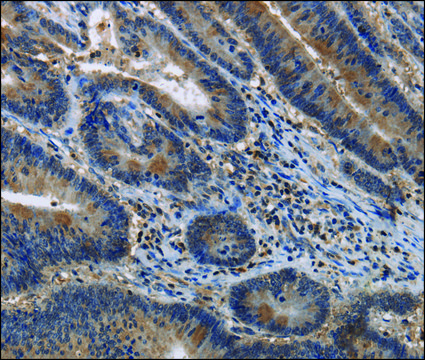 Anti-ITPR2 antibody produced in rabbit