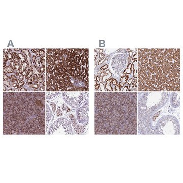 Anti-GCDH antibody produced in rabbit